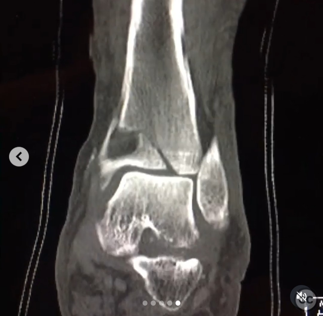 case image