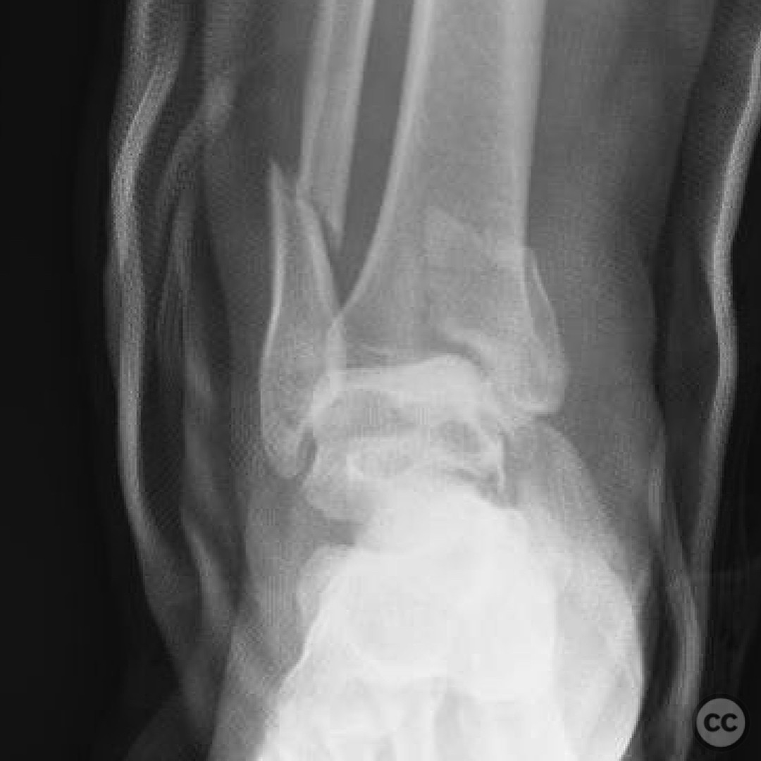 case image