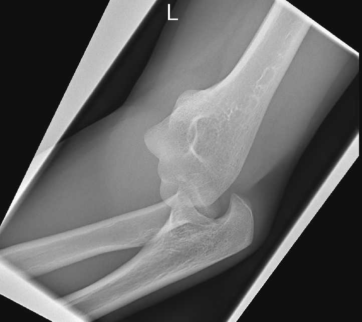 case image