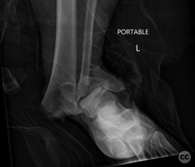 case image