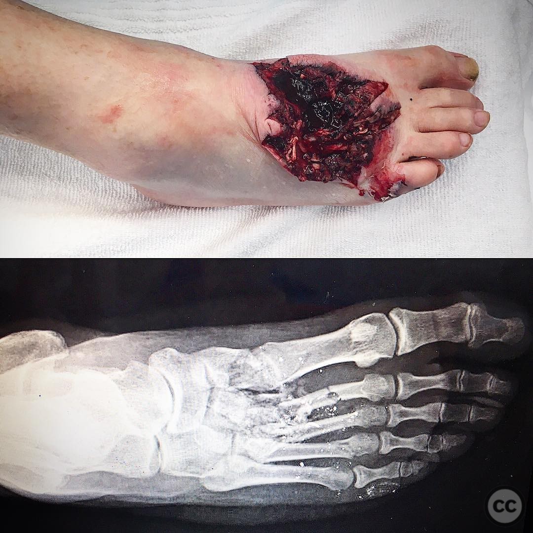 case image