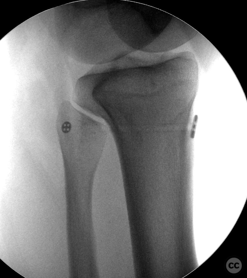 case image