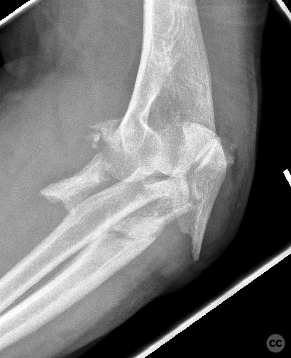 case image