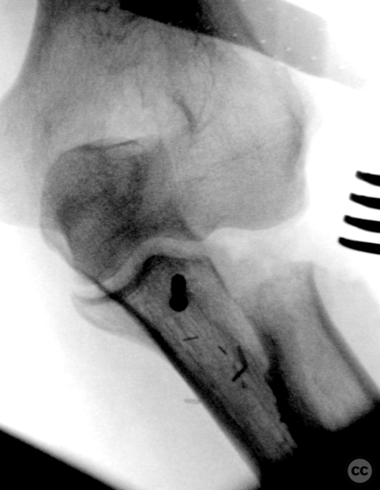 case image