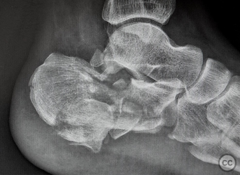 case image