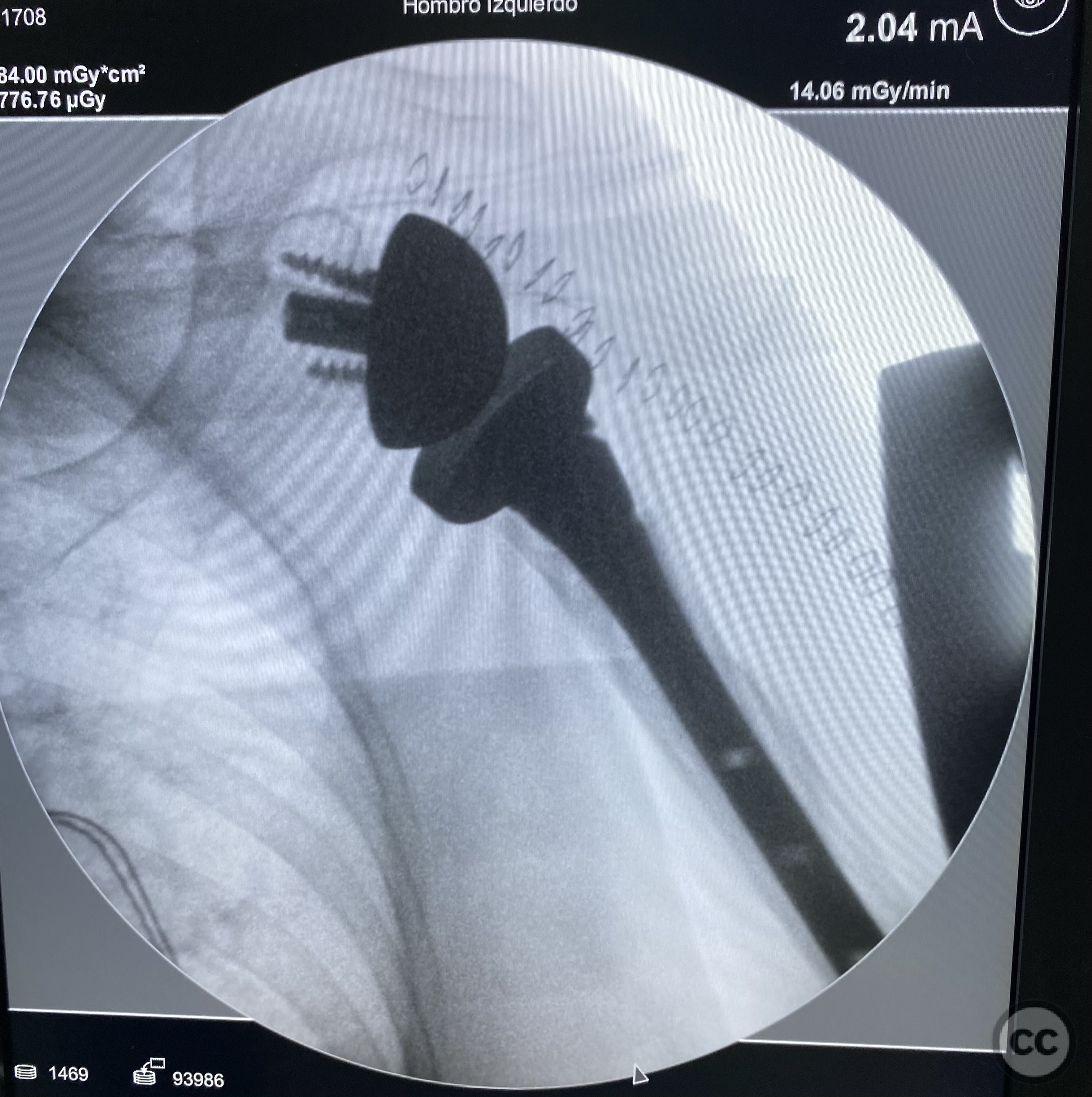 case image
