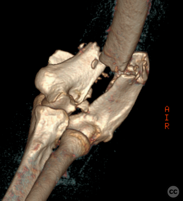 case image