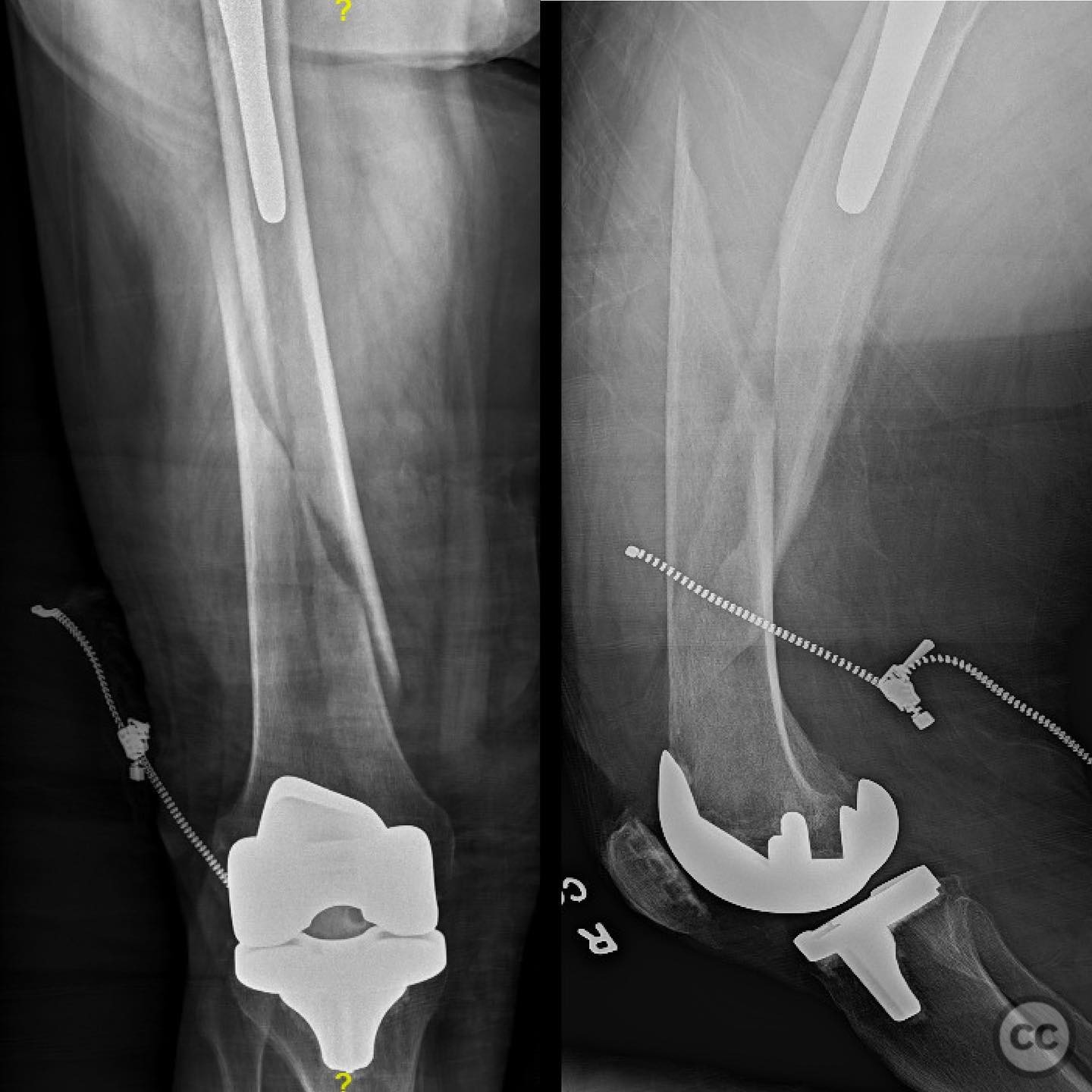 case image