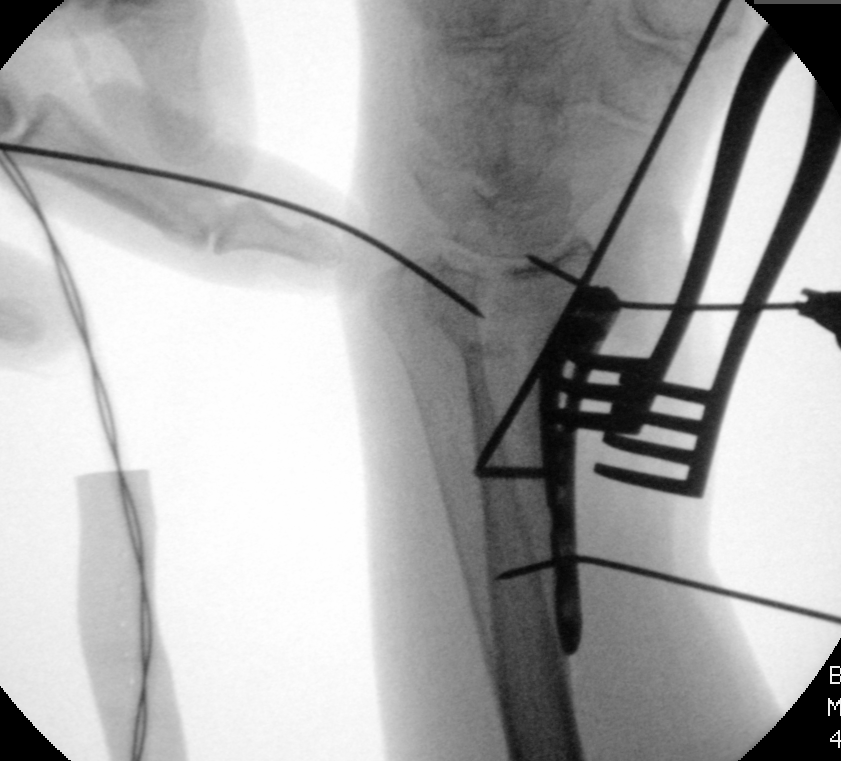 case image