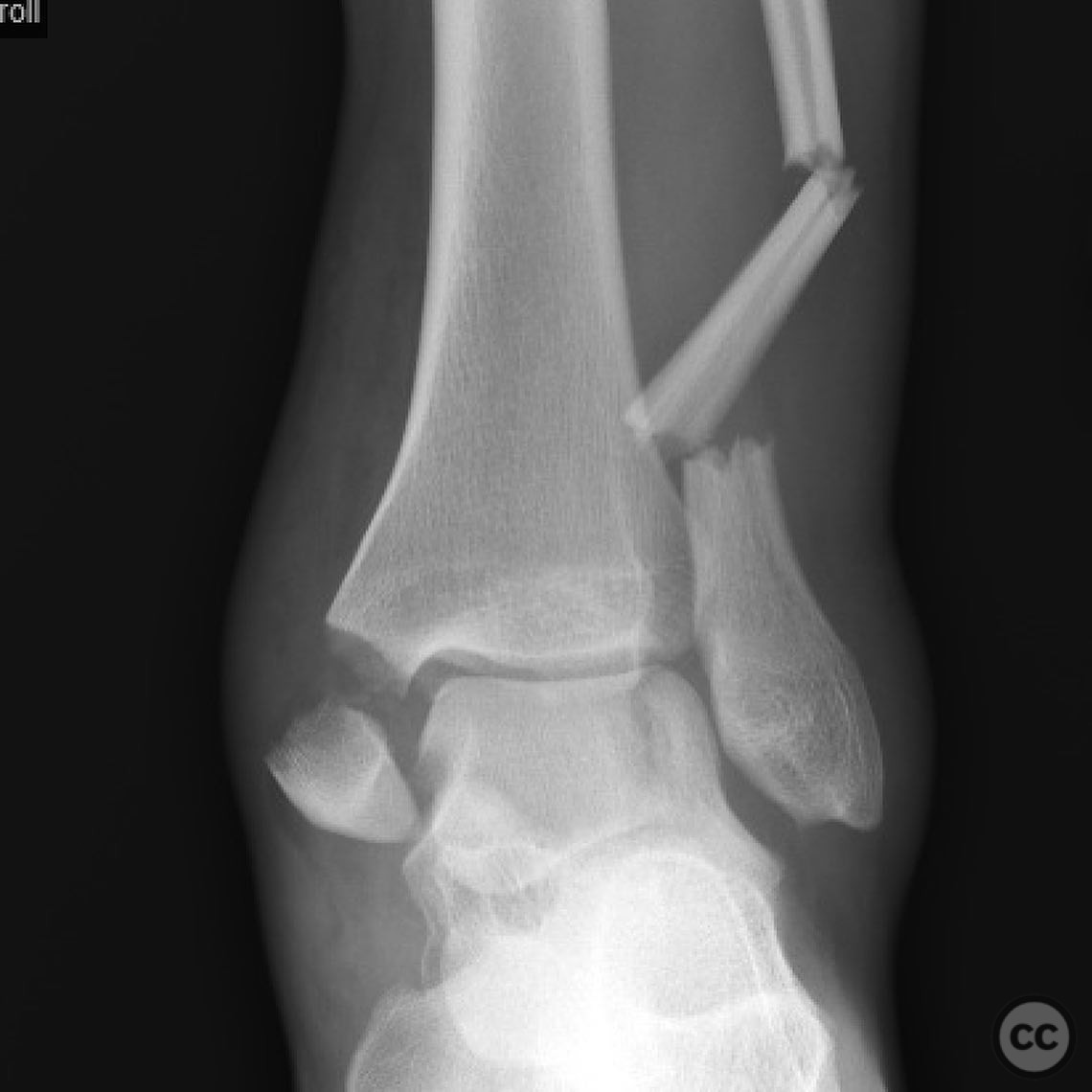 case image