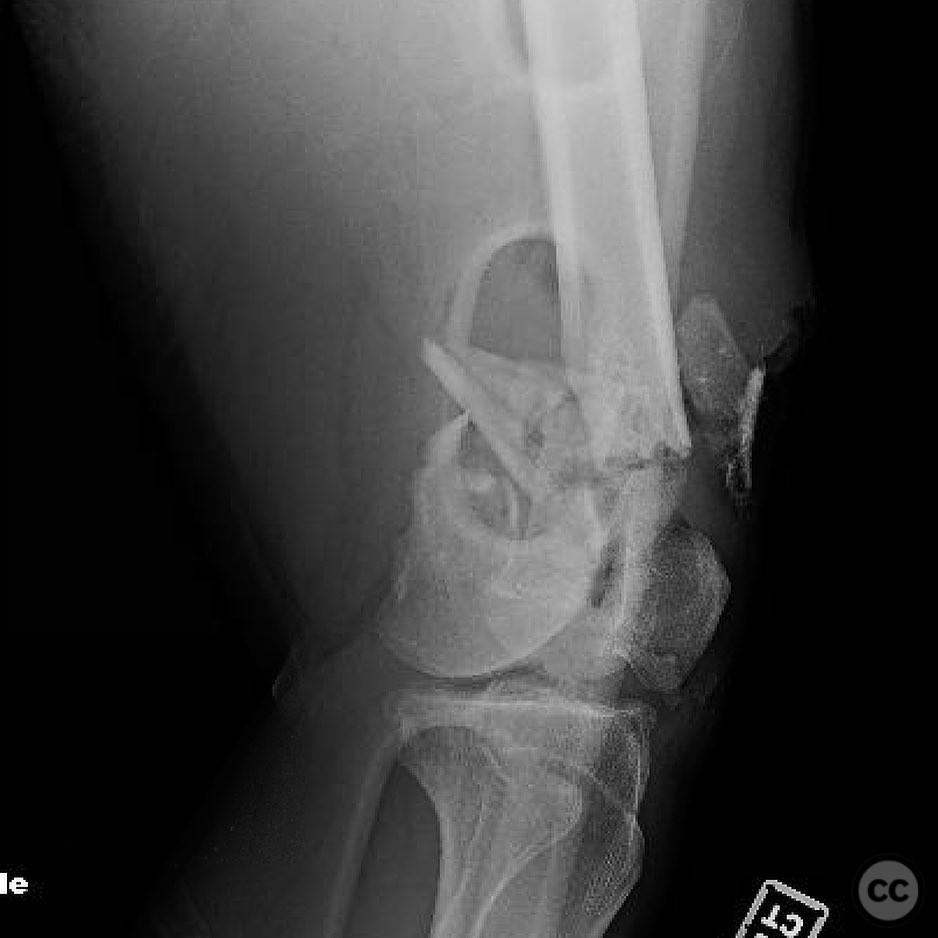 case image