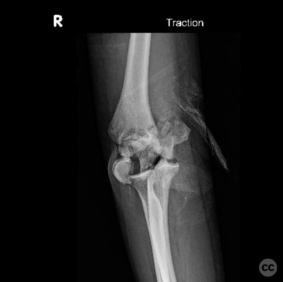 case image
