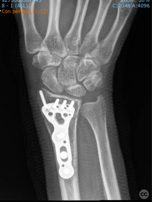 case image