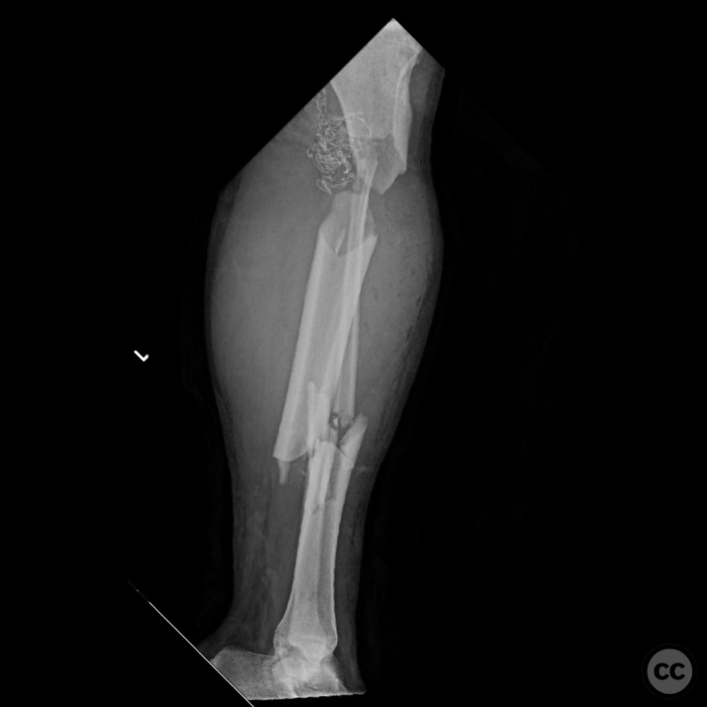 case image