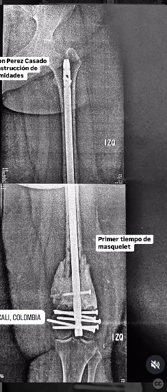 case image