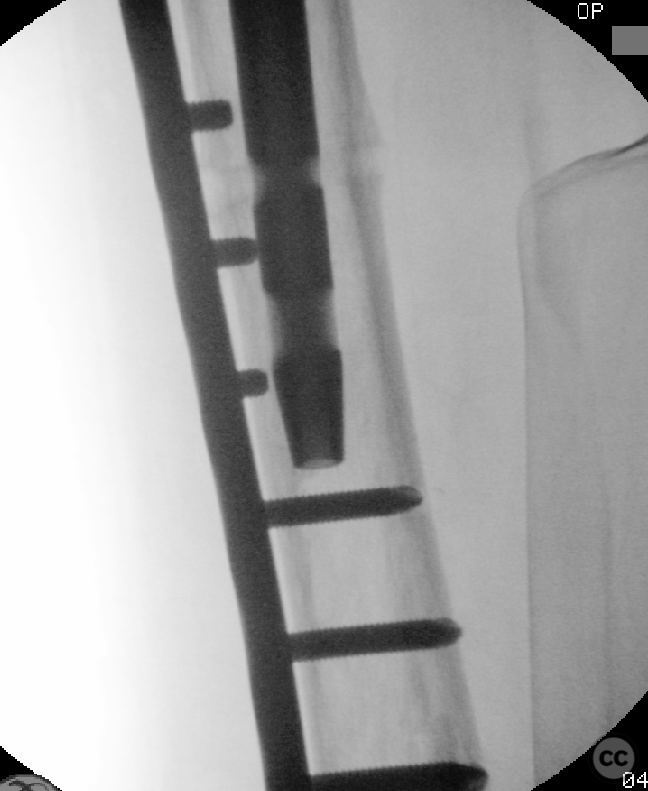 case image