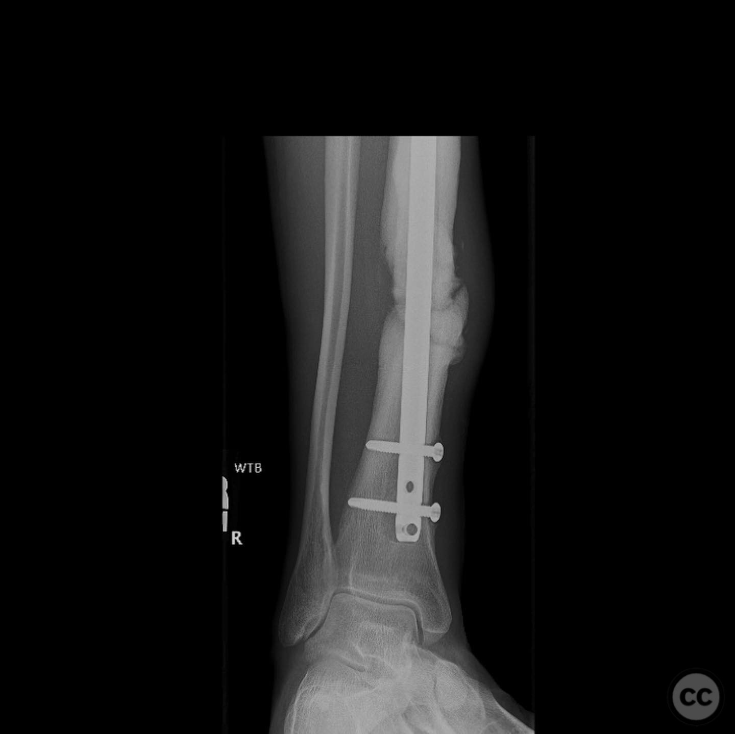 case image