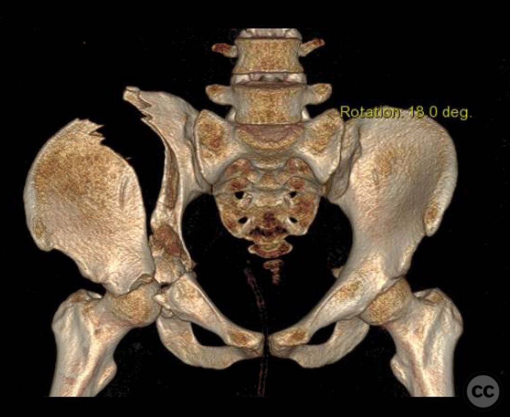 case image