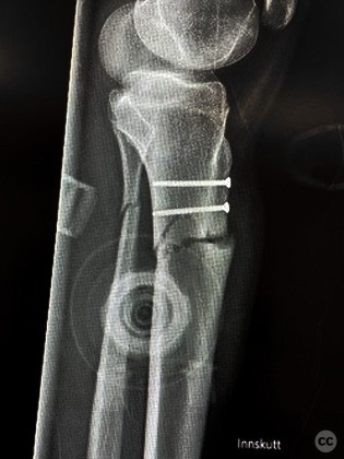 case image