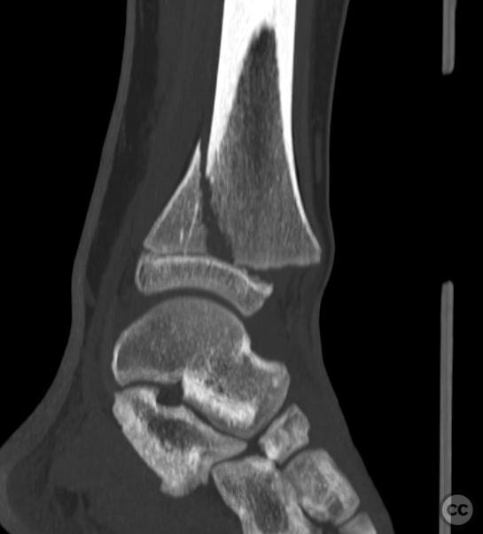 case image