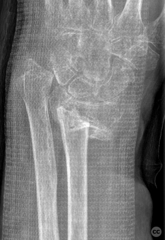 case image