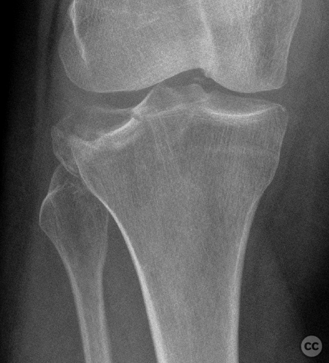 case image