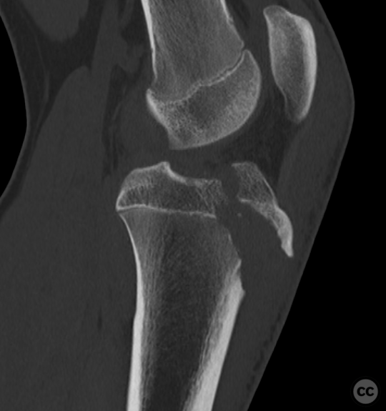 case image