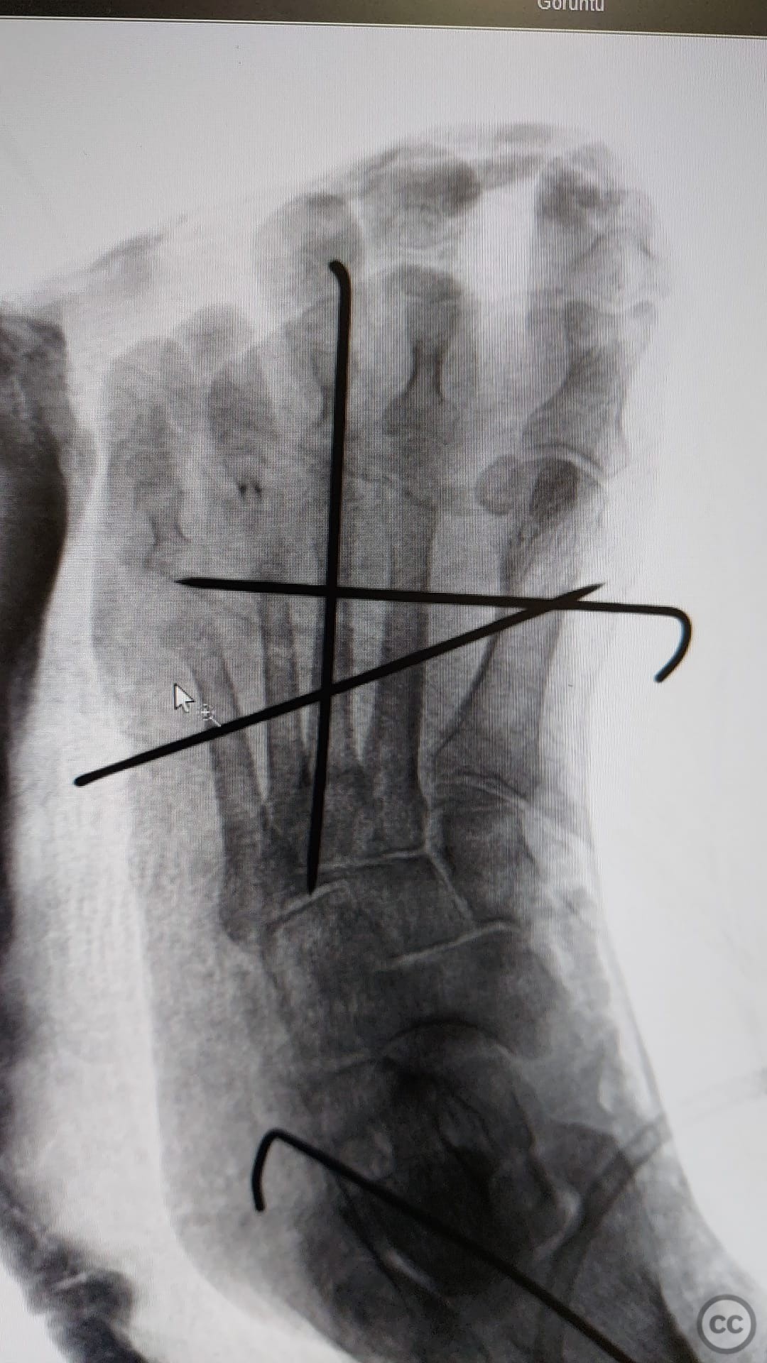 case image