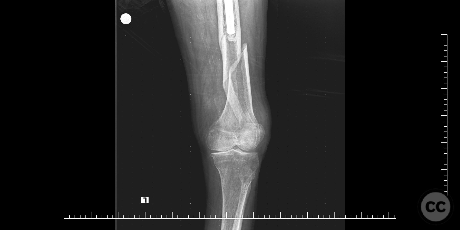 case image