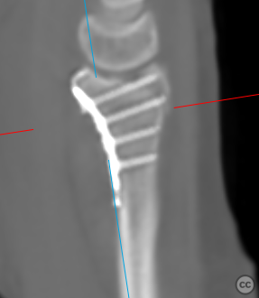 case image