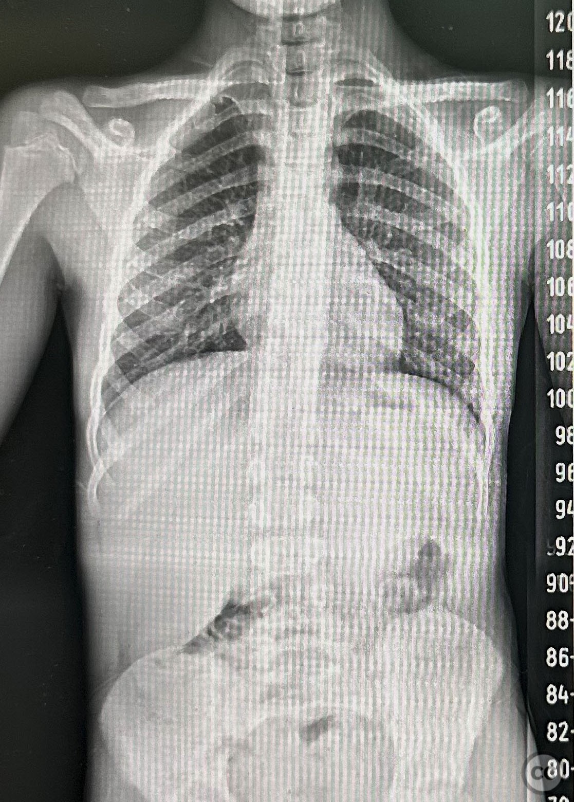 case image