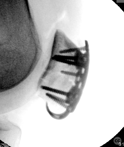 case image