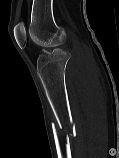 case image