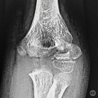 case image