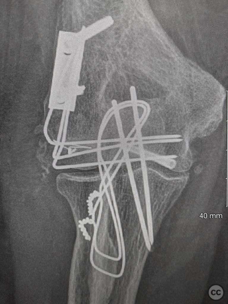 case image