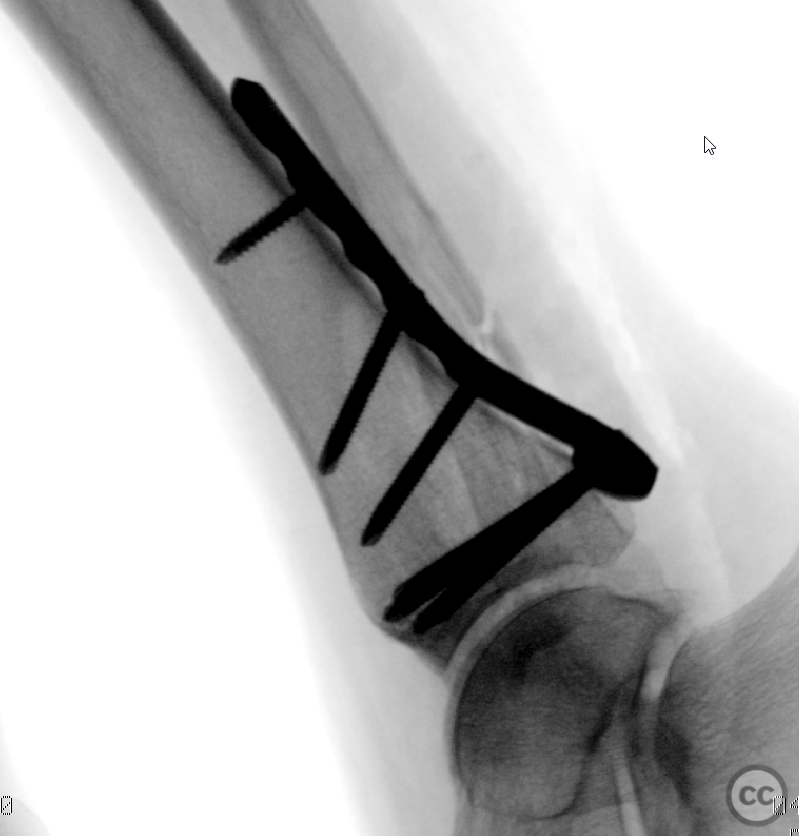 case image
