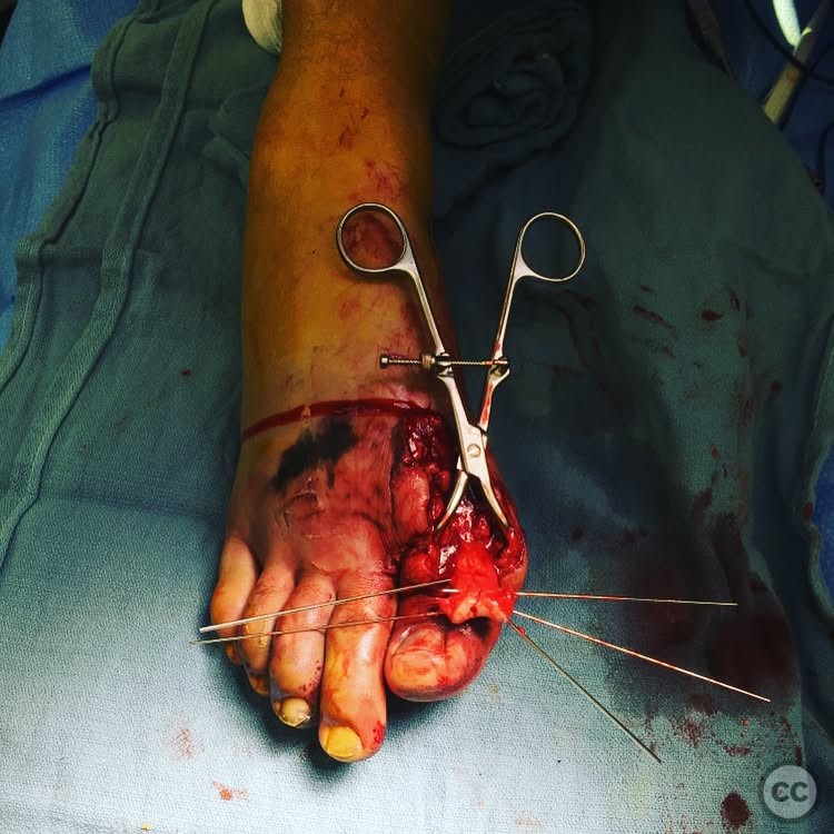 case image