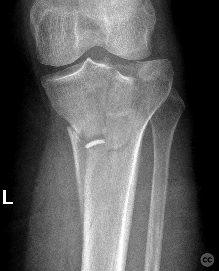 case image