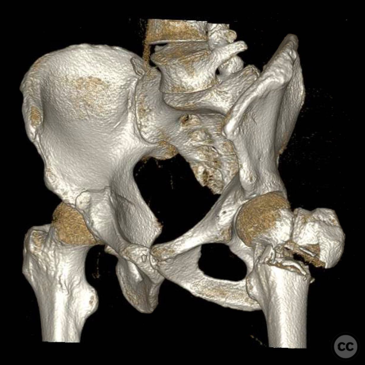 case image