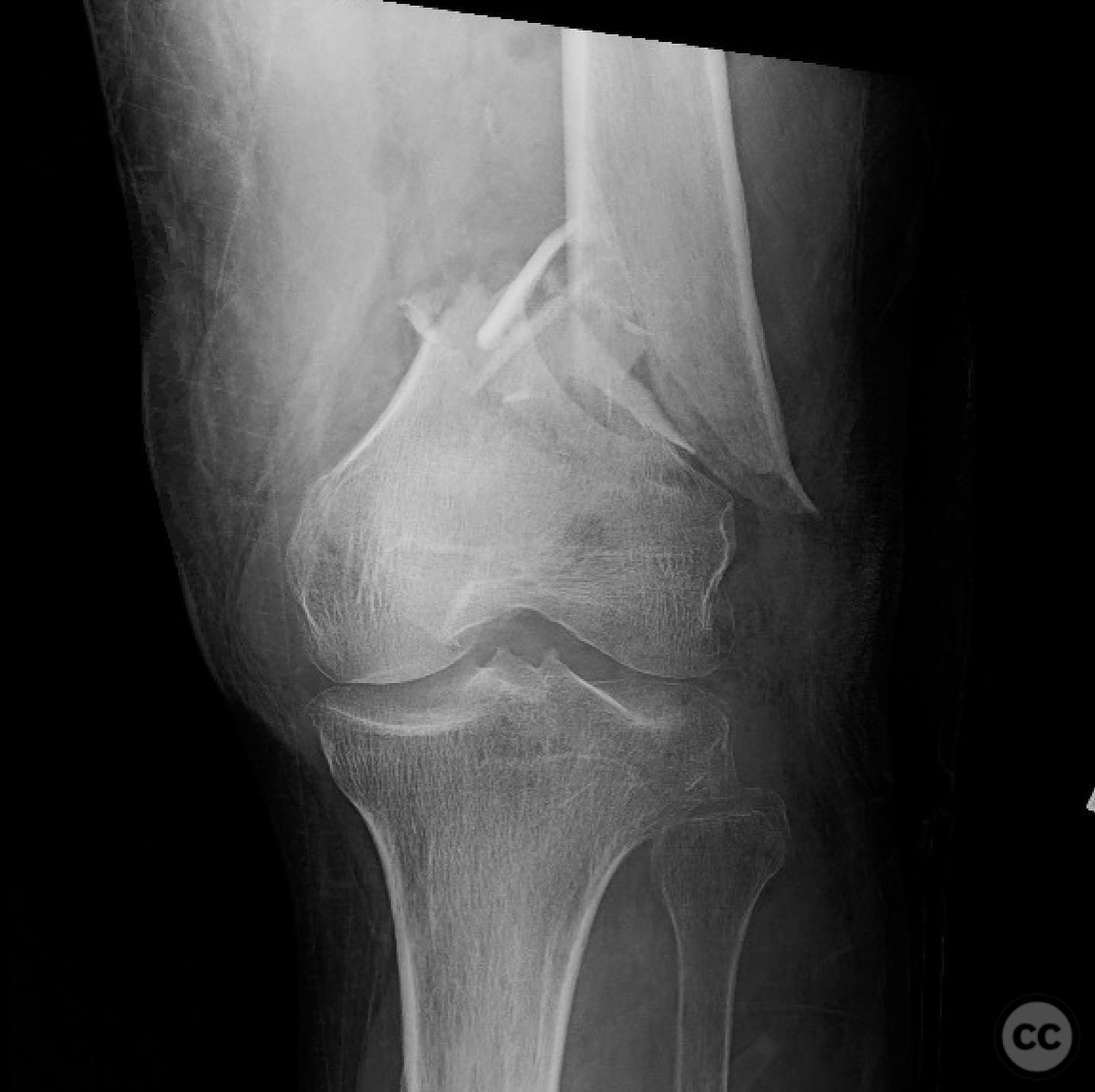 case image