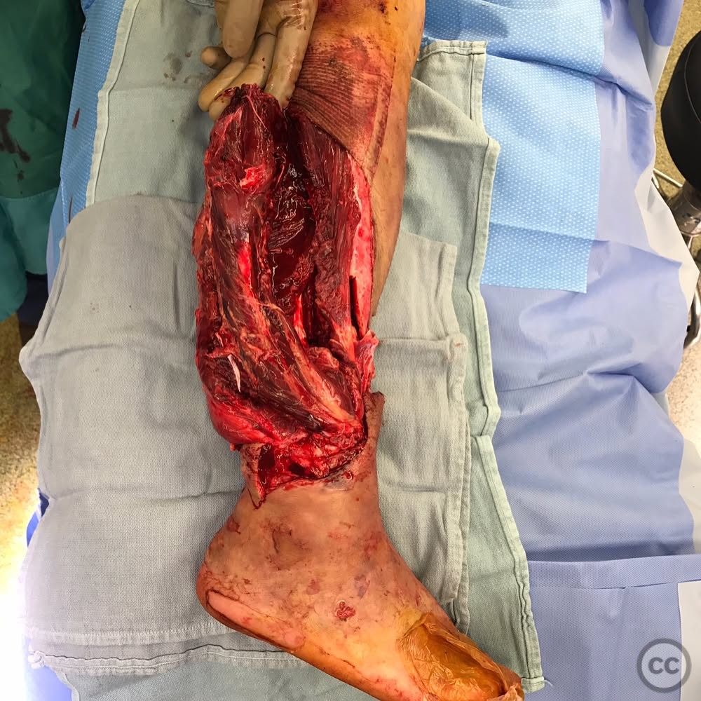 case image