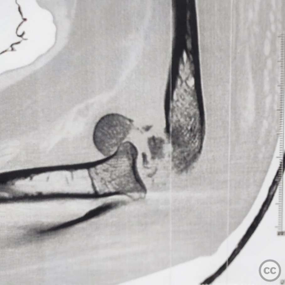 case image