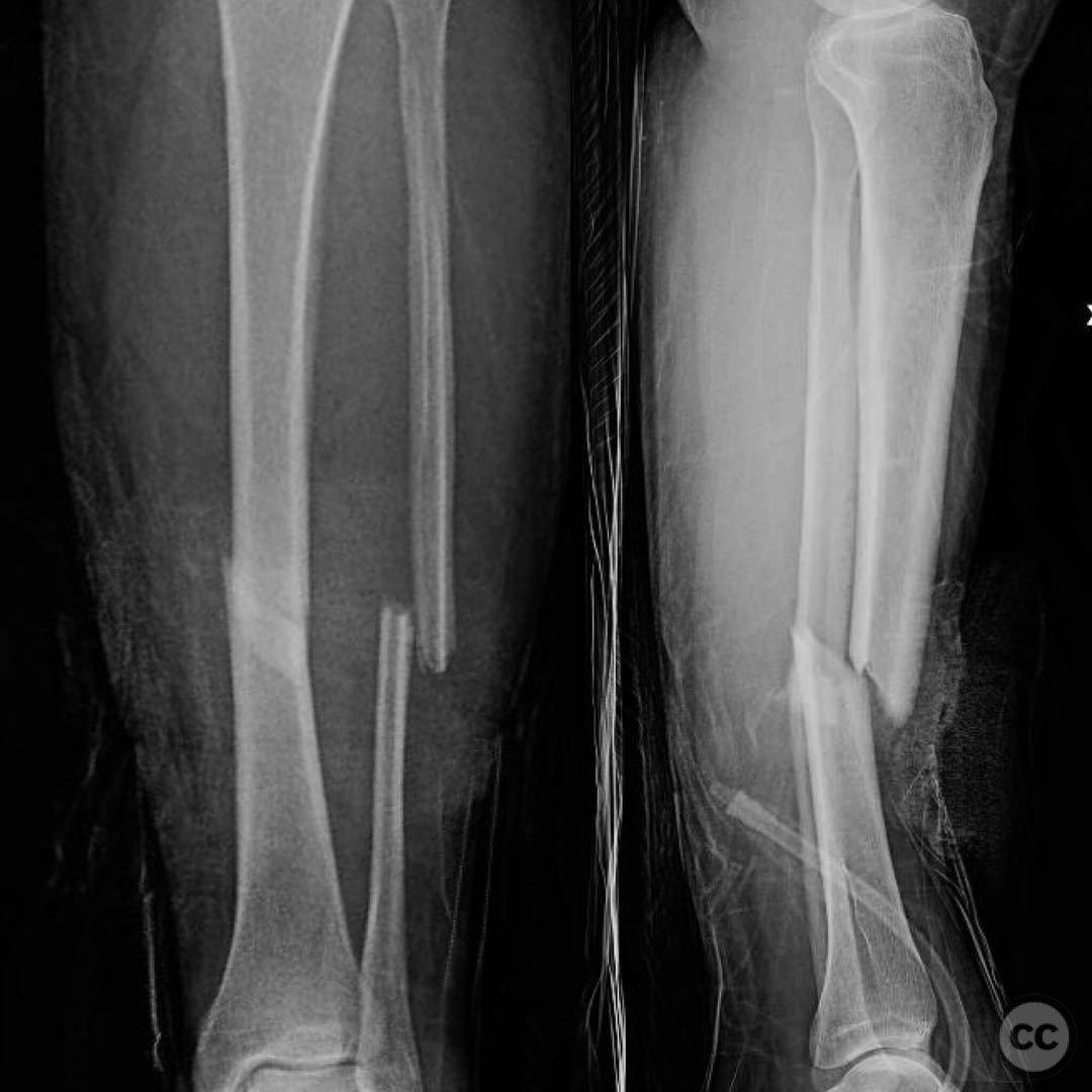 case image