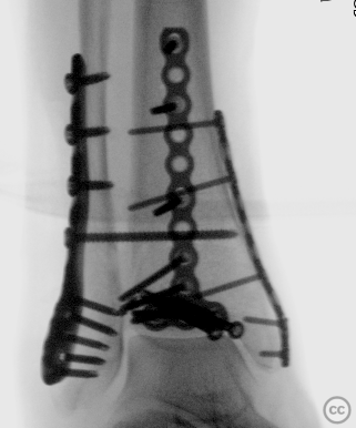 case image
