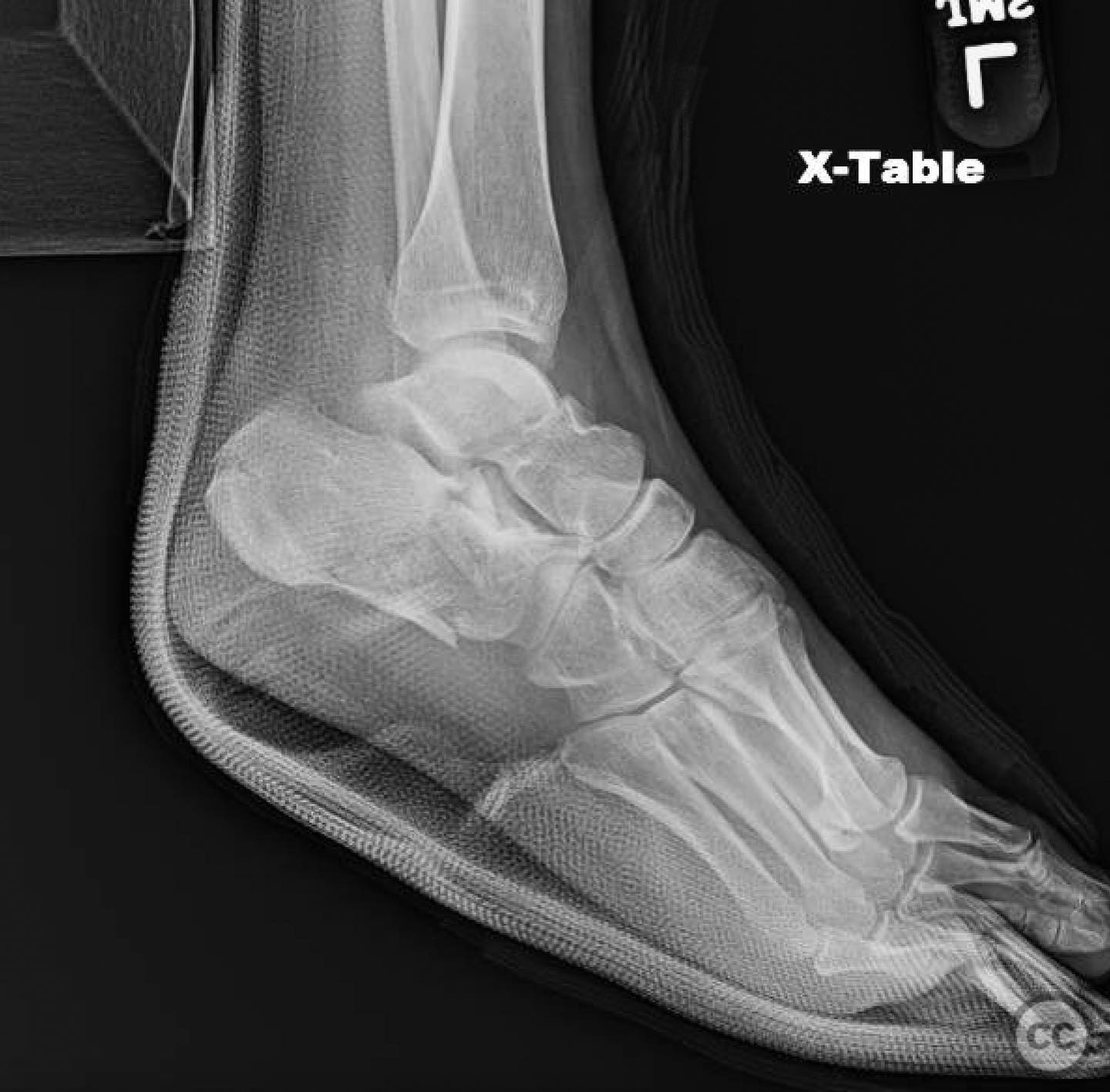 case image