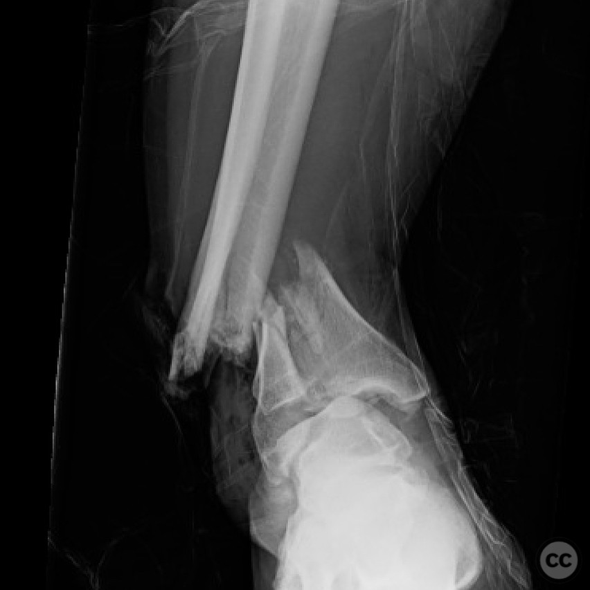 case image