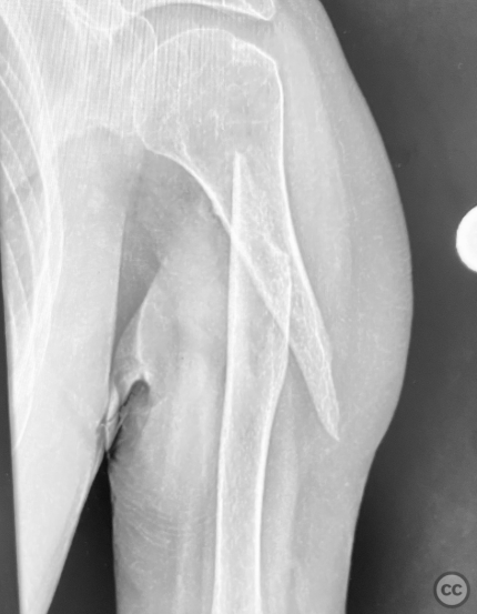 case image