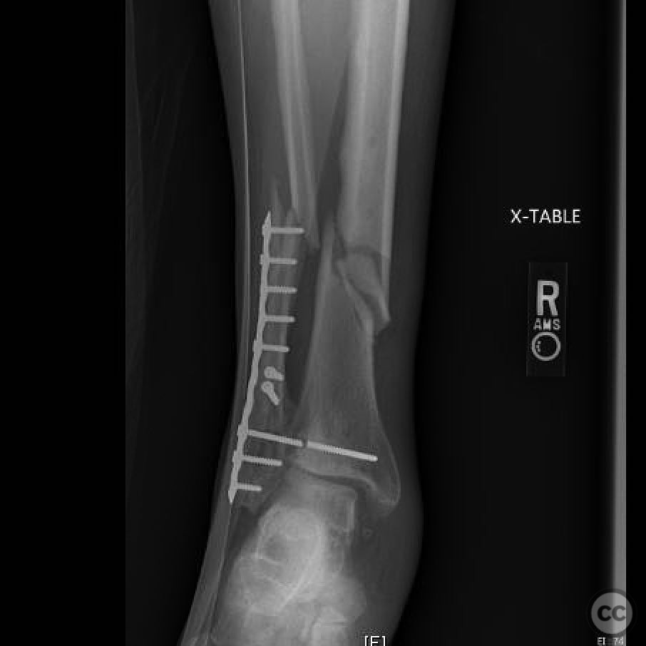 case image