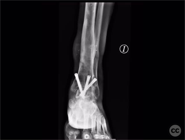 case image