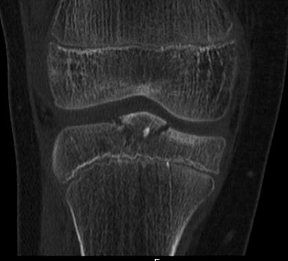 case image